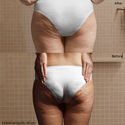 Cellulite Stimulation Kit